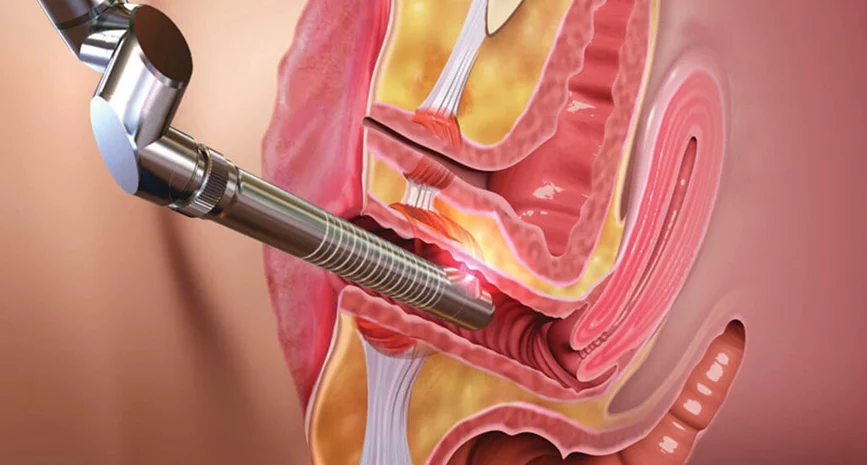 Cosmetic Laser Rejuvenation